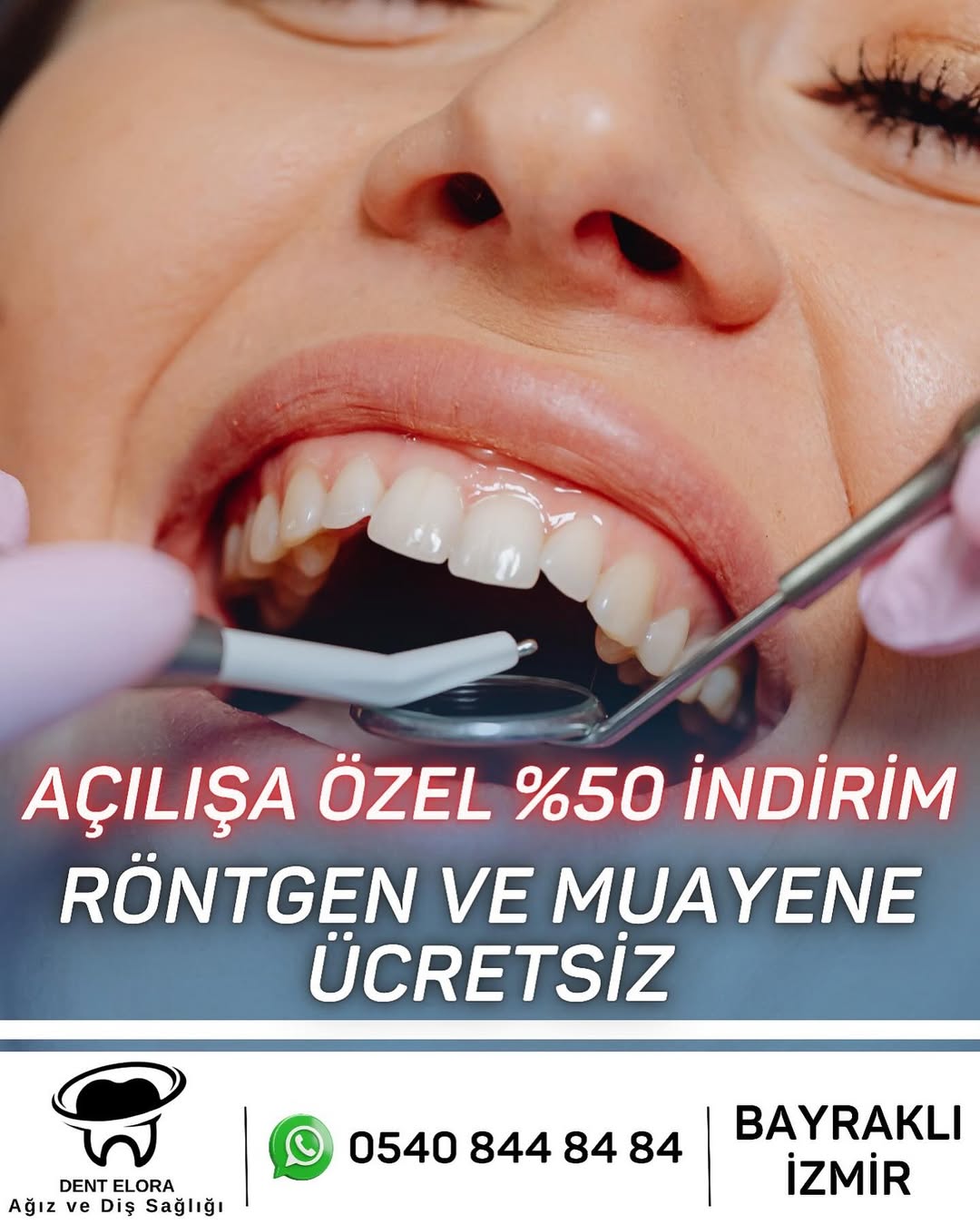 Diş Protez Bakımı